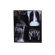 Digital X-ray Films，Dry Films, Thermal Films for Digital X-ray thumbnail-3