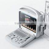 New Type Laptop Color Doppler Ultrasound for Human With Laptop thumbnail-3