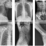 MY-D023-N High Frequency Radiology System Hospital Analogue Medical X-ray Equipment thumbnail-2