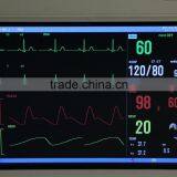 Low Cheap Portable 6 Parameter ECG/NIBP/SPO2/PR/TEM/REP 8-inch Patient Monitor With Optional Printer CE/ISO thumbnail-5