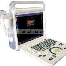 Hot Selling Medical Cheapest-portable-ultrasound-machine for Hospital and Clinic Use thumbnail-4