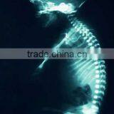 medical thermal x ray film,cheap medical equipment,conventional roentgenogram