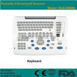 CE Approved Laptop/Portable Ultrasound Scanner With 3.5Mhz Multi-frequency Convex Probe RUS-9000B thumbnail-3