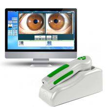 Digital Iriscope 12mp Iridology Camera Eye Iriscope Camera Analyzer thumbnail-2