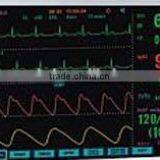 Medical Monitor thumbnail-5