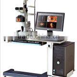 slit lamp prices