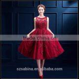 Top Quality Last Designs Round-neck Sleeveless Knee-length Lace Wedding Dress thumbnail-1