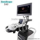 Trolley Medical Doppler Ultrasound Sonoscape S40 Price thumbnail-6