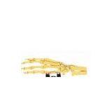 External Fixation :mini Fixator thumbnail-1