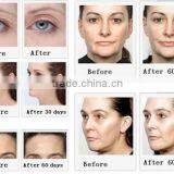 AYJ-T29B Thermagic Equipo rf Machine Have Cooling System thumbnail-4