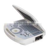 Medical Devices Digital Clear Imaging Portable Ultrasound Machine for Pregnancy thumbnail-6