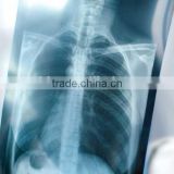 Film developing chemicals manufactures to chinese,medical dry film for x-ray equipment