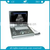 AG-BU009 protable clinical ultrasound machine