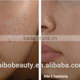 Skin Microdermabrasion Diamond Peeling Micro Dermabrasion Face Cleaning Machine thumbnail-6