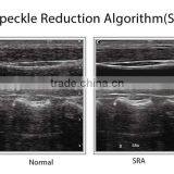 Medical User-friendly and Modern Design B/w 2d Portable Ultrasound Equipment Chison thumbnail-6
