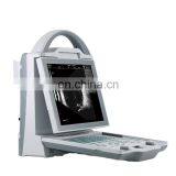 China High Quality ultrasound Ophthalmic scan Machine ophthalmic scanner Price /A&B scan ultrasound