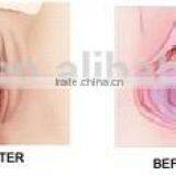 Face Lifting Cutting Head Fractional Head Vaginal Head F7+ CO2 Fractional Laser Machine Remove Neoplasms thumbnail-6