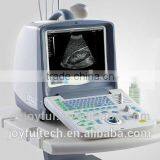 CE Marked Portable Joyful Ultrasound Machine for Pregnancy for Sale thumbnail-3