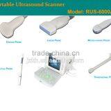 1 USB Factory Price OEM Design 80 Elements R60 Ultrasound Scanner for Pregnancy thumbnail-6