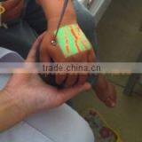 2015 New Portable Hospital Clinic Equipment Infrared Vein Finder With Cheap Price For Sale thumbnail-2