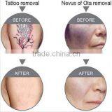 Best China Hot Sale!! Super Fast Color Touch Screen Iso13485 Emc/lvd ce Sfda Approved nd Yag Laser 10HZ thumbnail-6