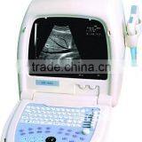 JOYFUL Price of Digital Ultrasound Machine thumbnail-3