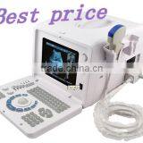 Good Price Full Digital Portable Ultrasound Scanner RUS-6000D With Linear Transvaginal Convex Microconvex Probe thumbnail-1