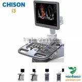 Mobile Trollely Fast 4D Volume Images Chison Color Doppler Ultrasound Price