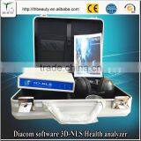 2017 Hot Hi-Tech 3D Health Analyzer Non Linear Diagnostics 3D MAR NLS Tester thumbnail-3