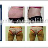 2mhz Factory Price Portable Effective Non Surgical Ultrasonic Liposuction Cavitation Rf Beauty Slimming Machine thumbnail-4