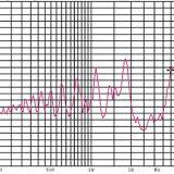 Piezoelectric Passive Buzze Scdz12*75 thumbnail-4