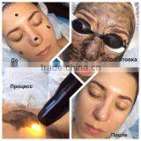 800mj Q-switch Tattoo Removal Nd Q Switch Laser Machine Yag Laser Long Pulse Nd:yag Equipment thumbnail-5