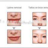 Portable1064 & 532 nm Tattoo Removal Machine for All Colors thumbnail-5