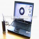 Image Automatic Measuring Instrument Model TEportable Brinell Hardness Tester thumbnail-2