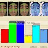 Computer Vision Skin Color Detection Skin Oil Diagnosis Skin Care Beauty Machine thumbnail-1