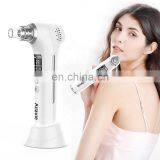 Luxury Ion Removal Blackhead Remover Pore Vacuum Pink Face Deep Pore Cleaner 2020 thumbnail-2