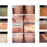 Portable China Beauty Salon Equipment With 808 Semiconductor Laser Painless Hair Removal thumbnail-4