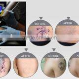 Multifunction Yag Laser Hair Removal Multi-languages Large Spot Size With Russia Imported Rod thumbnail-3