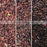 Shenzhen CCD Red Bean Color Sorter/Sorting Machine With Competitive Price / Good After-Sale Service thumbnail-5