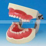 Dental Teeth Orthodontic Model/education Model/study Model thumbnail-1