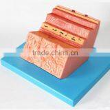 The Human Stomach Amplification Hierarchy Model of Gastric Digestive Department Special Amplification Model thumbnail-1