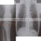 Konida Imagers x ra Blue Sensitive Films Medical Thermal Film China Film thumbnail-3