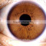 Portable 5MP Iridology Iriscope Analyzer thumbnail-5