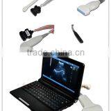 Light Weight Laptop Ultrasound Scanner RUS-9000F Optional Convex Probe Endocavity Trans Vaginal Micro Convex Linear Rectal thumbnail-1
