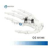 Orthofix Finger External Fixation Orthopedic Surgical Instruments Type D