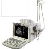 Economical and Functional Digital Ultrasound Scanner, High Sensitivity 10" monitor