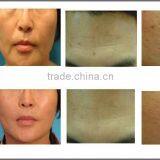Wrinkle Removal Beauty Instrument RF Micro Needle Skin Rejuvenation Fractional Machine thumbnail-3