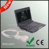 Laptop Ultrasonic Diagnostic System