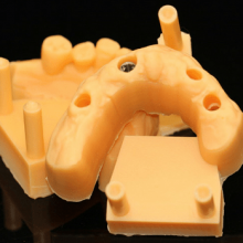 Digital-Crowns-Bridges Chinese Dental Lab Denture thumbnail-2