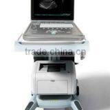 Sonostar Hospital Veterinary Equipment B Model Ultrasound Machine for Sale V9 thumbnail-5
